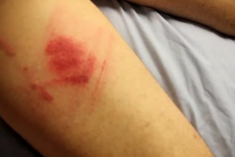 This Sub Posted On BBRT That he Was Looking For A B*utal Motherfucker To Spank Him Hard And That The dom Top Could Do whatsoever he Wanted So lengthy As he Was A 'man'. I Decided To Take Up The challenge And see How Far he Would Go. About An Hour In 